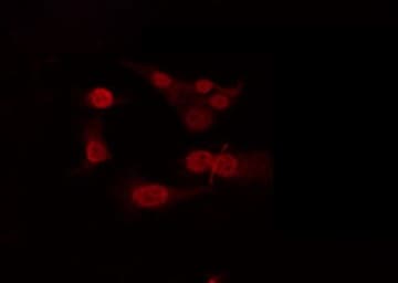 Polyclonal Rabbit anti-Human TBX22 Antibody (IF, WB)