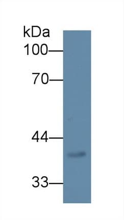 Dipeptidase 2 / DPEP2 Antibody (Biotin)