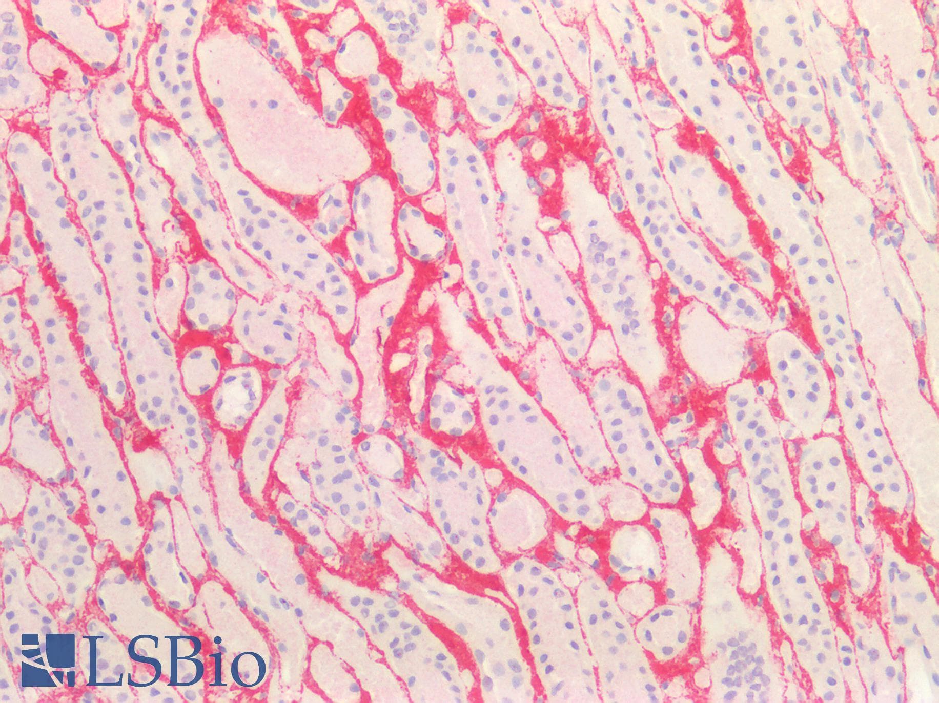 PathPlus™ COL3A1 / Collagen III Antibody