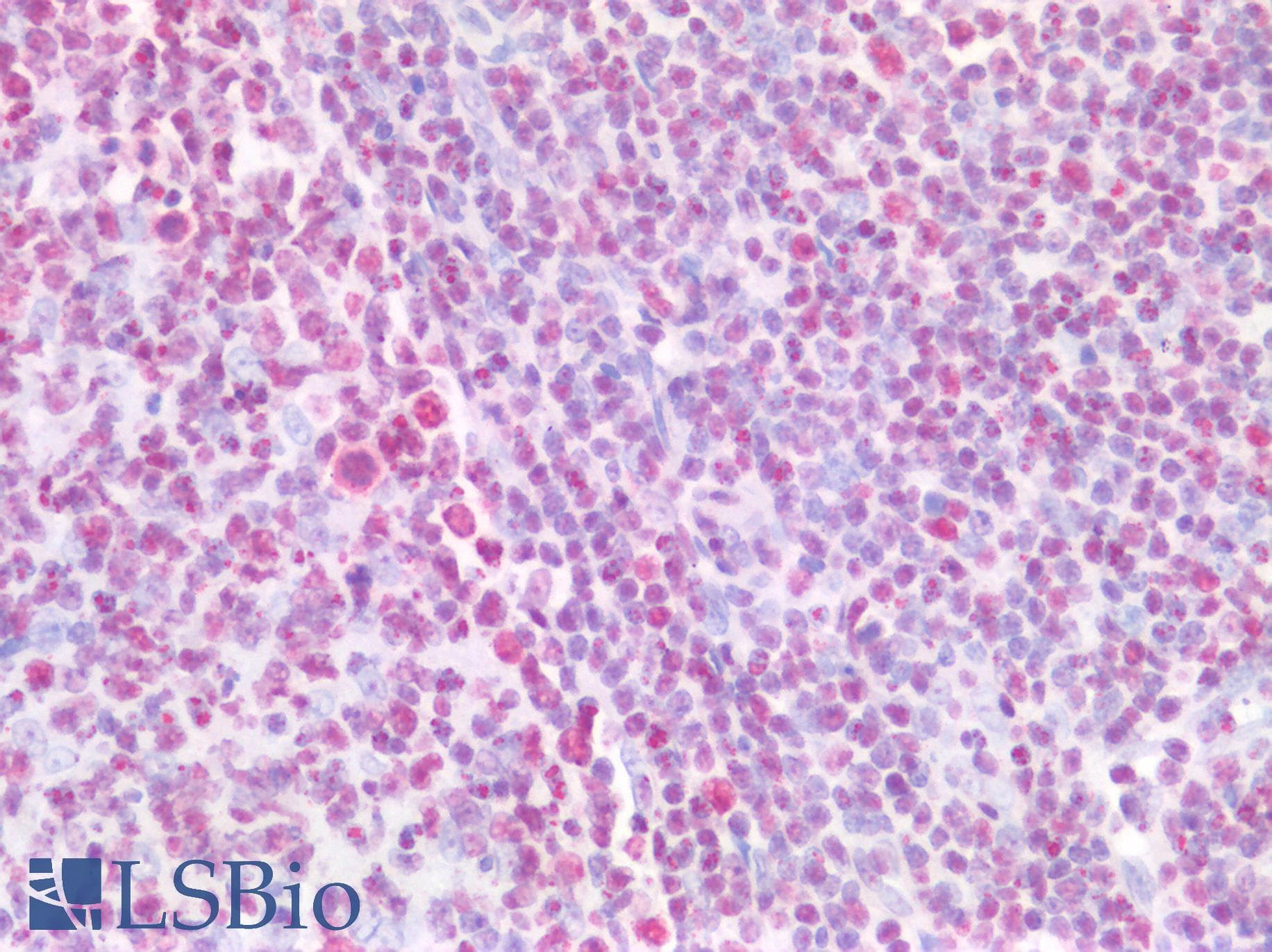 PathPlus™ IKZF1 / IKAROS Antibody