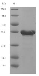 Human IL-10 Protein (Recombinant 6His-SUMO, N-terminus)
