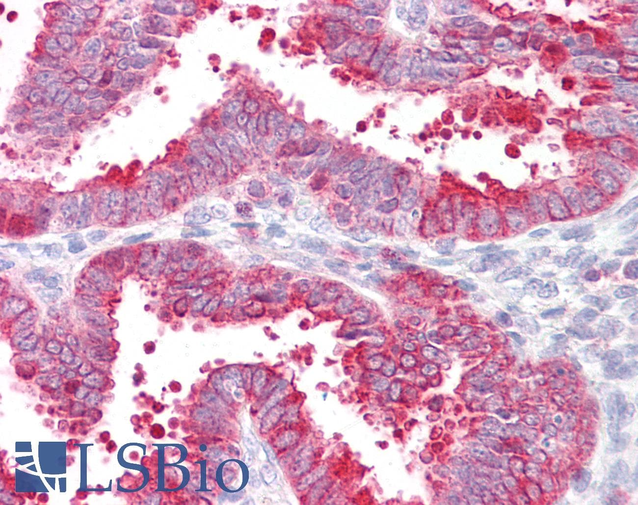 IHC-plus™ EZR / Ezrin Antibody (aa511-560)