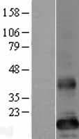 TMEM86B Protein (Over-Expression Lysate Myc-DDK (Flag))