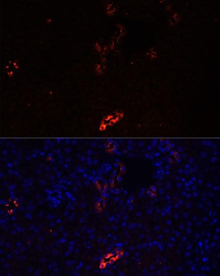 AQP2 / Aquaporin 2 Antibody