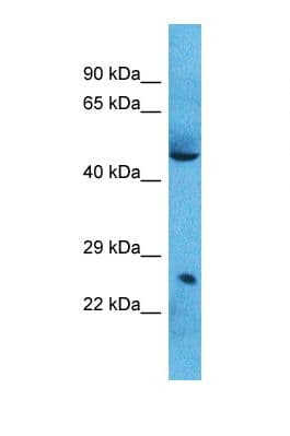 Polyclonal Rabbit anti-Human SPI1 / PU.1 Antibody (N-Terminus, WB)