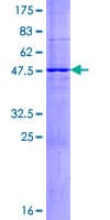 Human ABCC5 / MRP5 Protein (Recombinant GST)