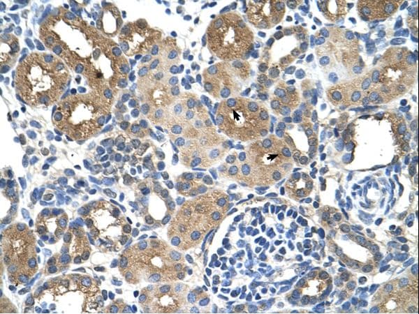 Polyclonal Rabbit anti-Human DCXR Antibody (aa151-200, IHC, WB)