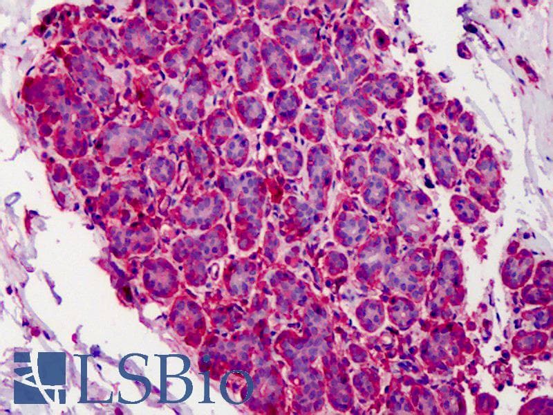 IHC-plus™ Monoclonal Mouse anti-Bovine CAPN1 / Calpain 1 Antibody (clone 15C10, IHC, WB)
