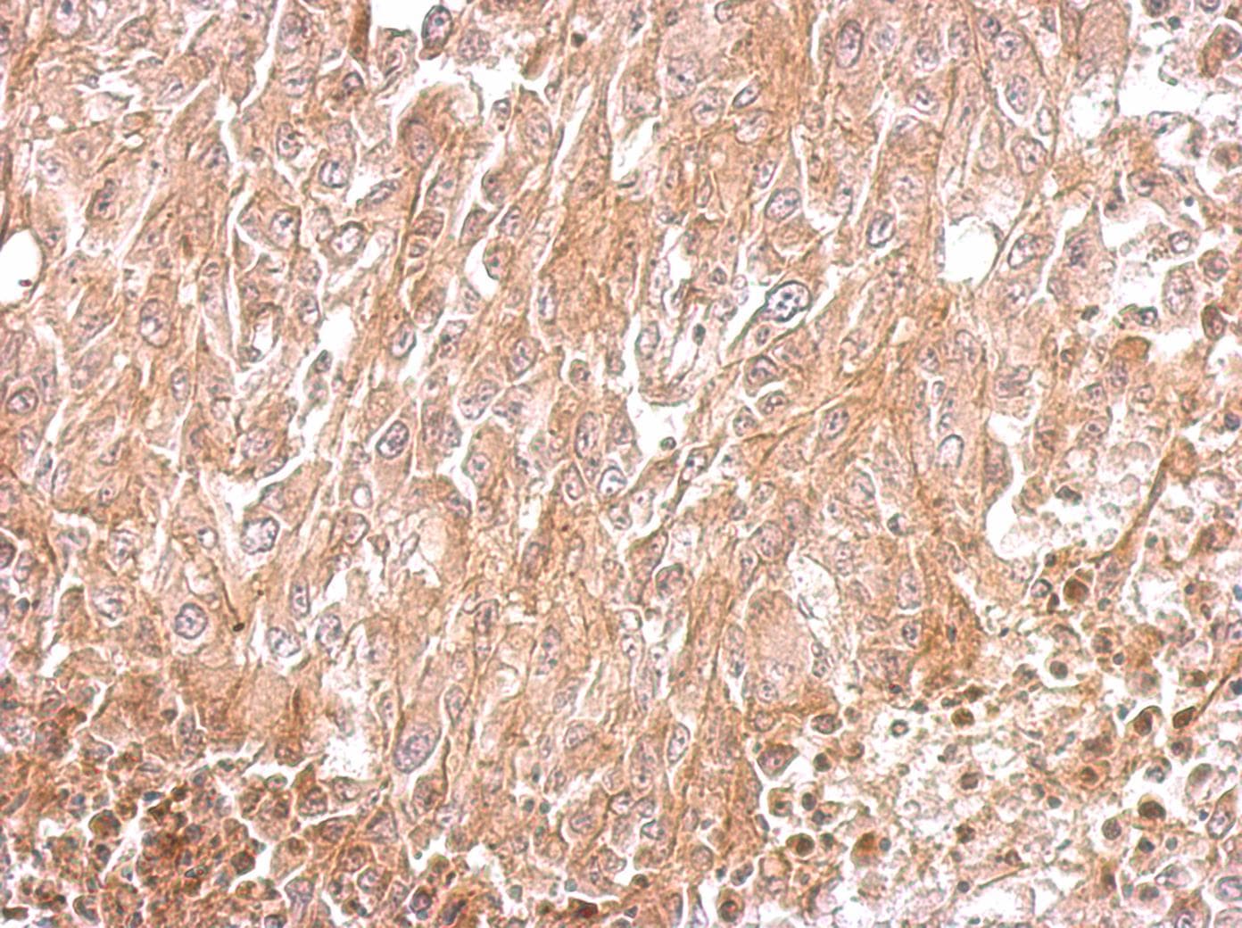 Polyclonal Rabbit anti-Human AMPH / Amphiphysin Antibody (aa1-194, IHC, WB)