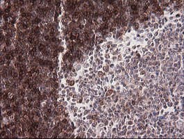 CD1C Antibody (clone OTI1F4)