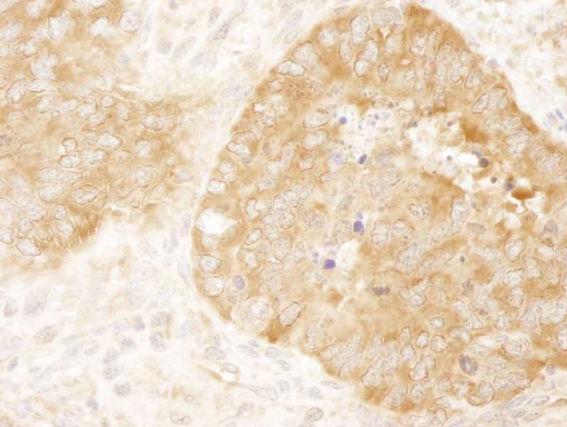 EIF2S1 Antibody (aa275-C-term)