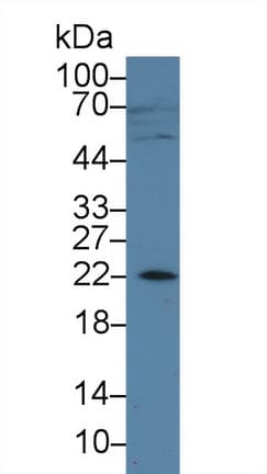 AMELX Antibody (aa49-187, PE)