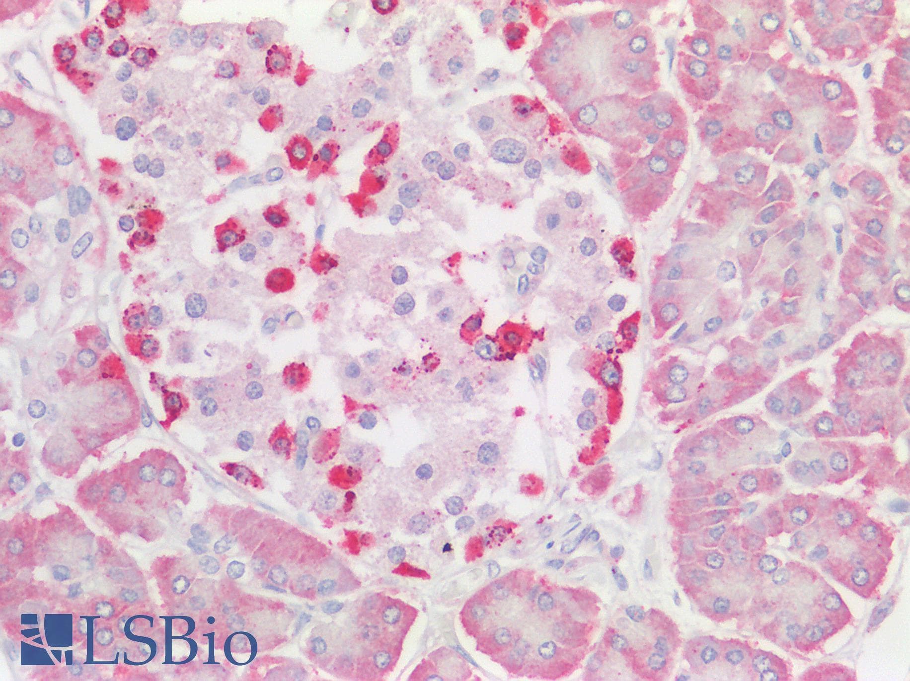 Polyclonal Rabbit anti-Human OS9 Antibody (C-Terminus, IHC, WB)