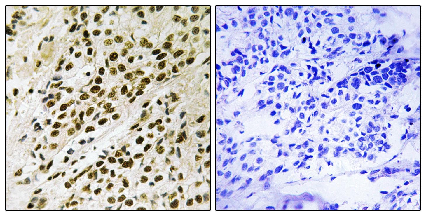 MAPKAPK5 / PRAK Antibody (phospho-Thr182)