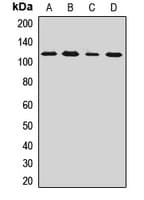 Polyclonal Rabbit anti-Human C17orf70 Antibody (WB)