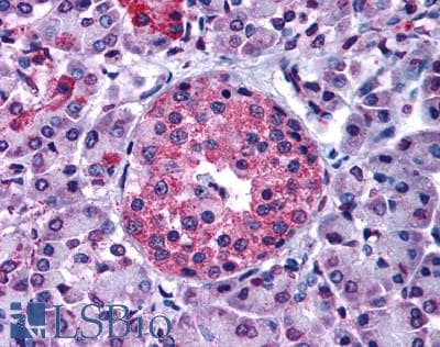 IHC-plus™ GIPR / GIP Receptor Antibody (N-Terminus)