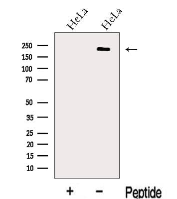 CD118 / LIF Receptor Alpha Antibody