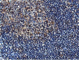 ILVBL Antibody (clone OTI8A12)