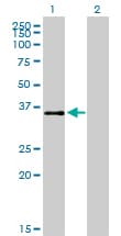 IHC-plus™ ATF1 Antibody (clone 3E7)