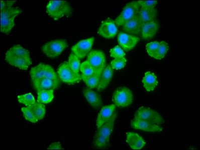 UBE2L3 / UBCH7 Antibody