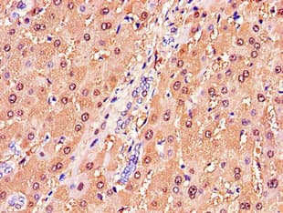 GSTA1 Antibody