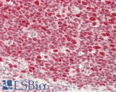 IHC-plus™ Polyclonal Rabbit anti-Human RCC1 Antibody (IHC, WB)