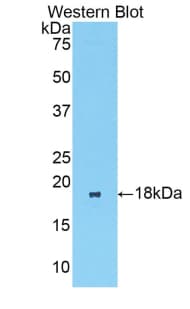 BCL2L11 / BIM Antibody (aa2-120, Biotin)