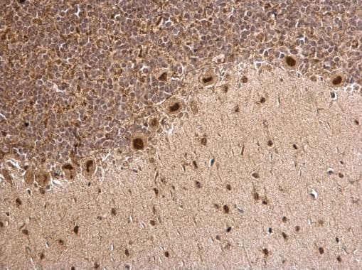 MTA1 Antibody (aa391-708)