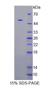 Human CADPS Protein (Recombinant His-GST, N-terminus)