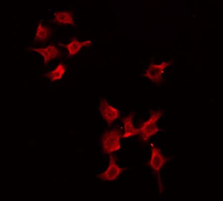 Polyclonal Rabbit anti-Human PGBD1 Antibody (IF, WB)