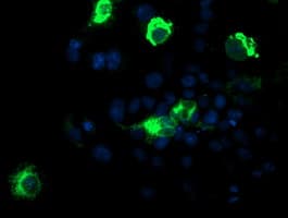 Monoclonal Mouse anti-Human CPA1 / Carboxypeptidase A Antibody (clone OTI1C1, IF, WB)
