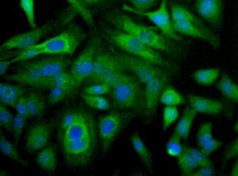 SCARB1 / SR-BI Antibody