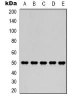 FH / Fumarase / MCL Antibody