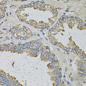 ALDH3A1 Antibody