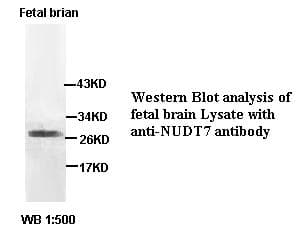 Polyclonal Rabbit anti-Human NUDT7 Antibody (IHC, WB)