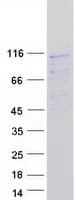 Human PEX6 Protein (Recombinant Myc-DDK (Flag))
