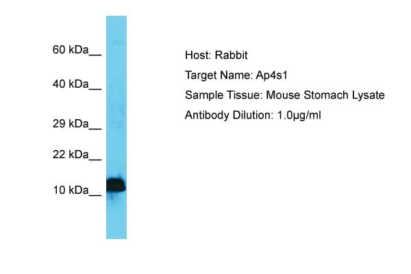 Polyclonal Rabbit anti-Mouse AP4S1 Antibody (N-Terminus, WB)