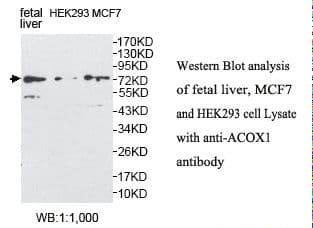 ACOX1 / ACOX Antibody (aa361-649)