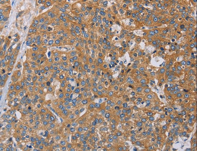 ACTN4 Antibody