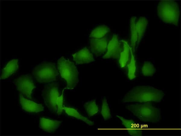 LGALS1 / Galectin 1 Antibody (clone 1E8-1B2)