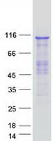 Human CPSF2 Protein (Recombinant Myc-DDK (Flag))