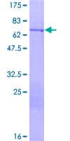 Human KRT16 / CK16 / Cytokeratin 16 Protein (Recombinant GST)