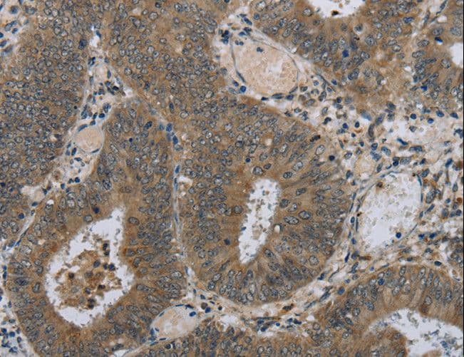 HSD3B1 Antibody
