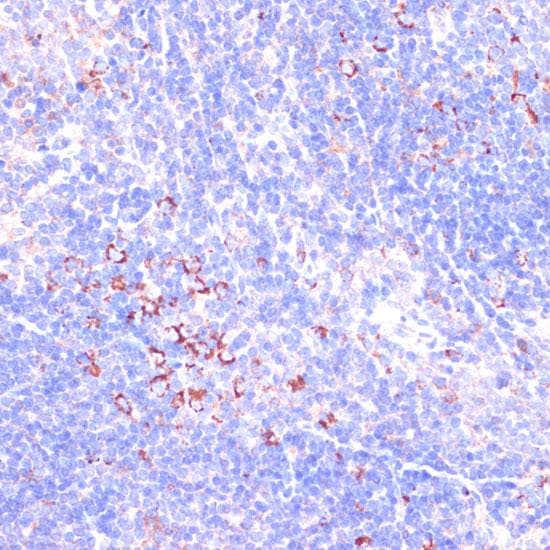 Polyclonal Rabbit anti-Human Zyxin Antibody (IHC, IF, WB)