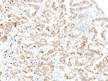 KRT7 / CK7 / Cytokeratin 7 Antibody (clone SPM270)