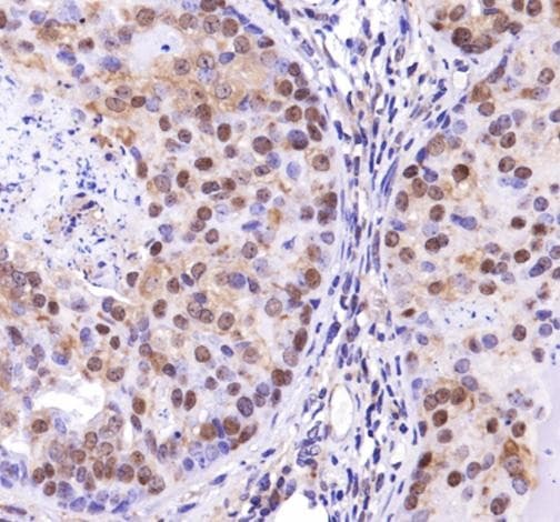 TP53INP2 Antibody