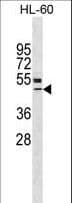 Vitamin D Receptor / VDR Antibody