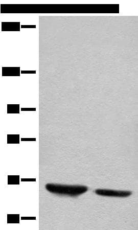 DENND1B Antibody