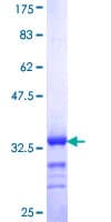 Human RBM39 Protein (Recombinant GST, N-terminus)