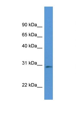 Polyclonal Rabbit anti-Mouse RPIA / RPI Antibody (aa119-168, WB)